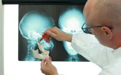 Dental professional examining jaw anatomy with model and X-ray images, highlighting temporomandibular joint (TMJ) and related conditions.